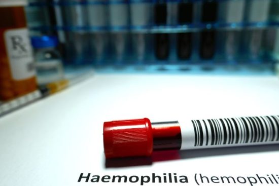 Haemophilia Treatment Market