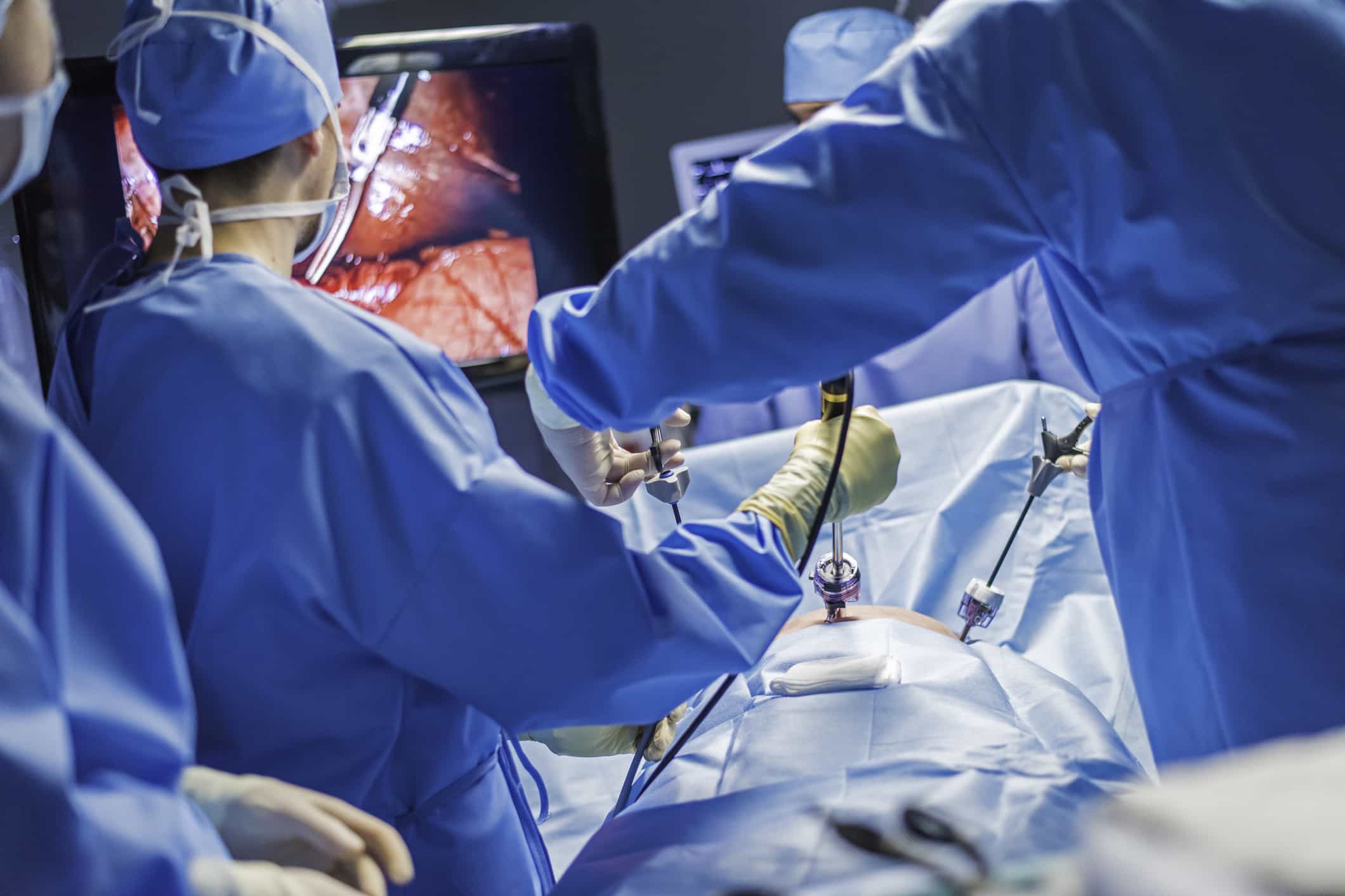 Laparoscopic Hernia Surgery in Guwahati