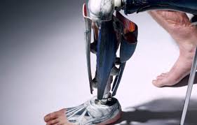 Orthopedic Prosthetics Market