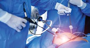 United States Endoscopy Devices Market