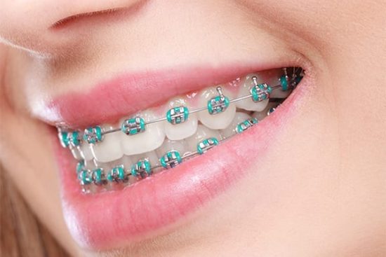 orthodontics