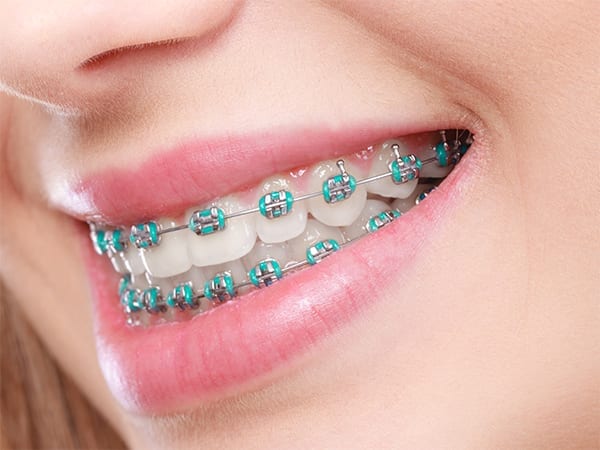 orthodontics