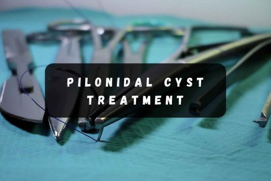 pilonidal cyst treatment