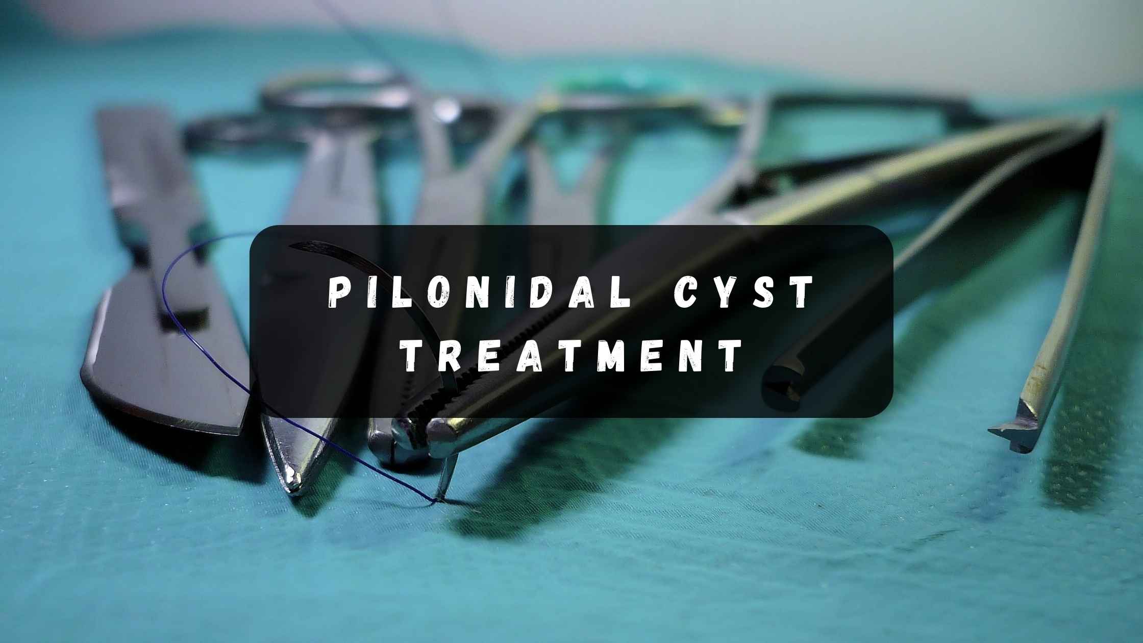 pilonidal cyst treatment