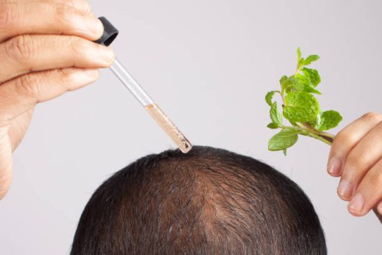 prp hair treatment in islamabad