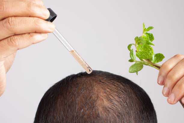 prp hair treatment in islamabad