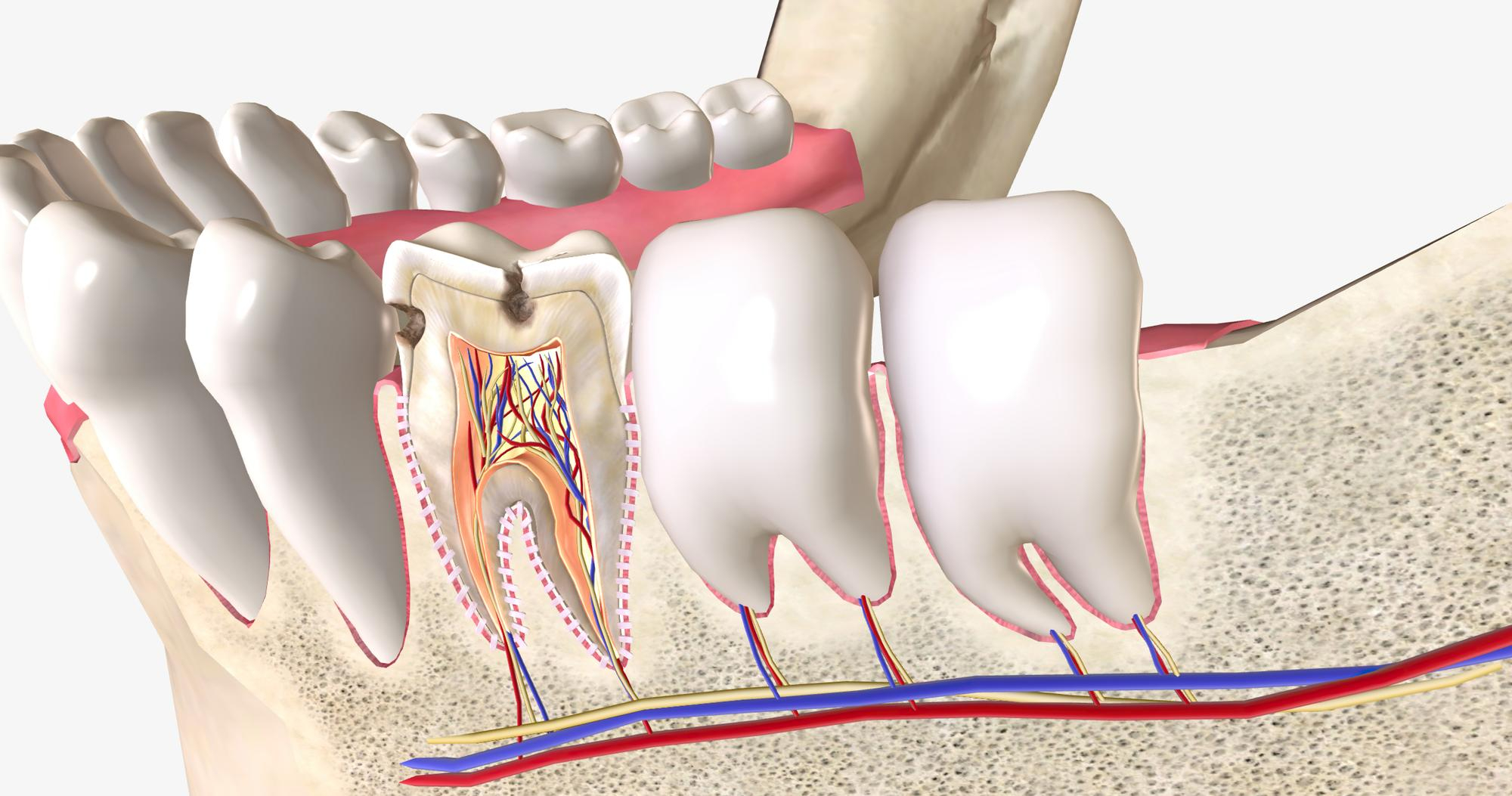 root canal treamtment  uu857