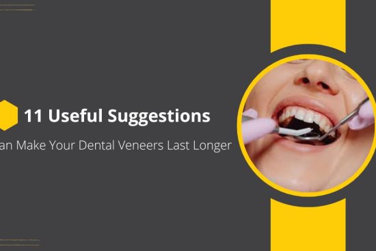 11 Useful Suggestions That Can Make Your Dental Veneers Last Longer