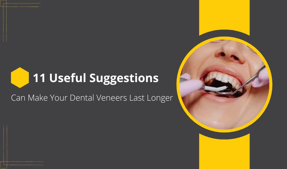 11 Useful Suggestions That Can Make Your Dental Veneers Last Longer