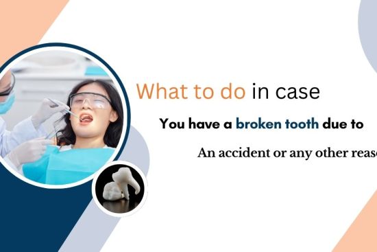 What to do in case you have a broken tooth due to an accident or any other reason