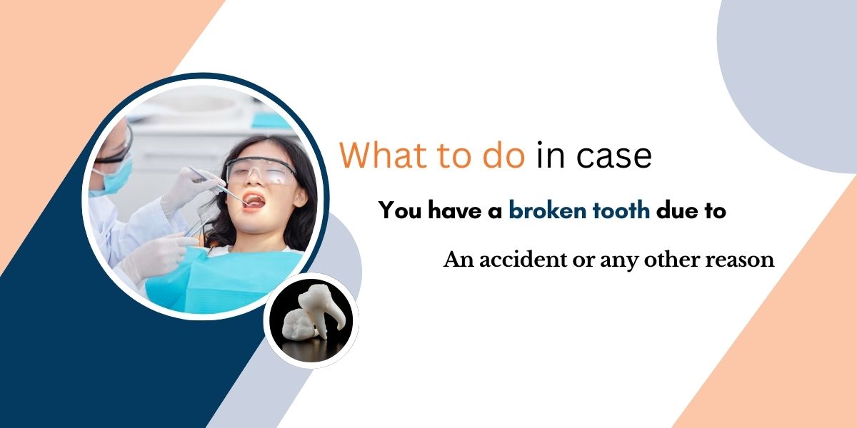 What to do in case you have a broken tooth due to an accident or any other reason