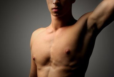 gynecomastia